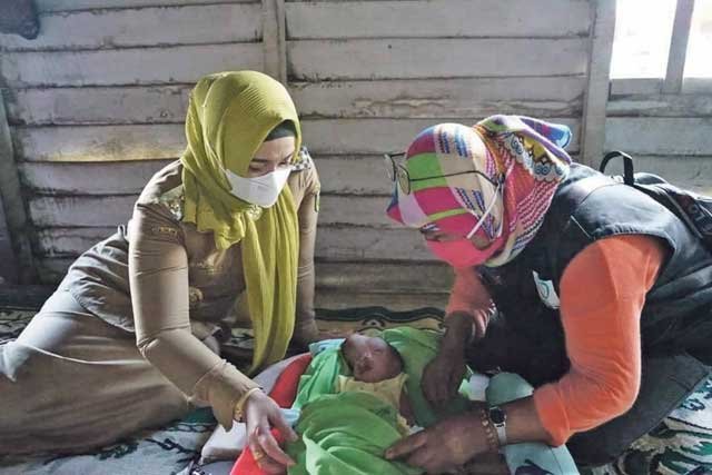 Bayi yang Lahir tanpa Tulang Tengkorak