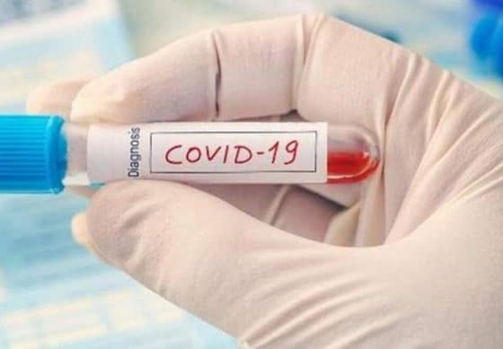 dokumen swab antigen