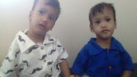kembar siam