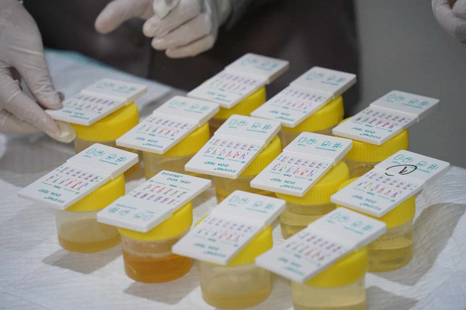 sampel tes urine