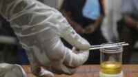 tes urine