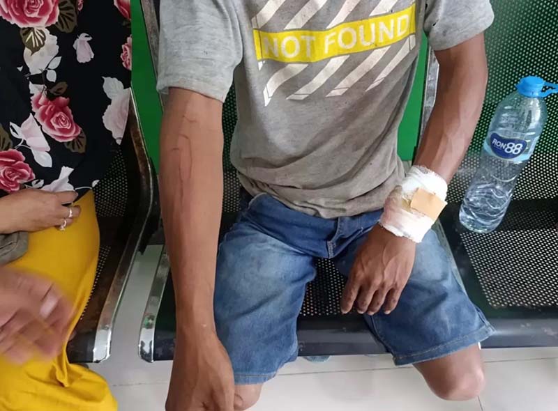 diterkam buaya