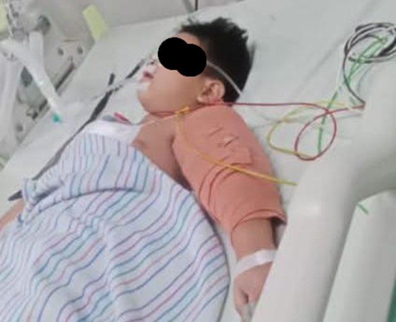 bocah tertancap besi koma