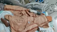 kondisi-sj-di-ruang-icu-rumah-sakit-hanau kondisi sj di ruang icu rumah sakit hanau